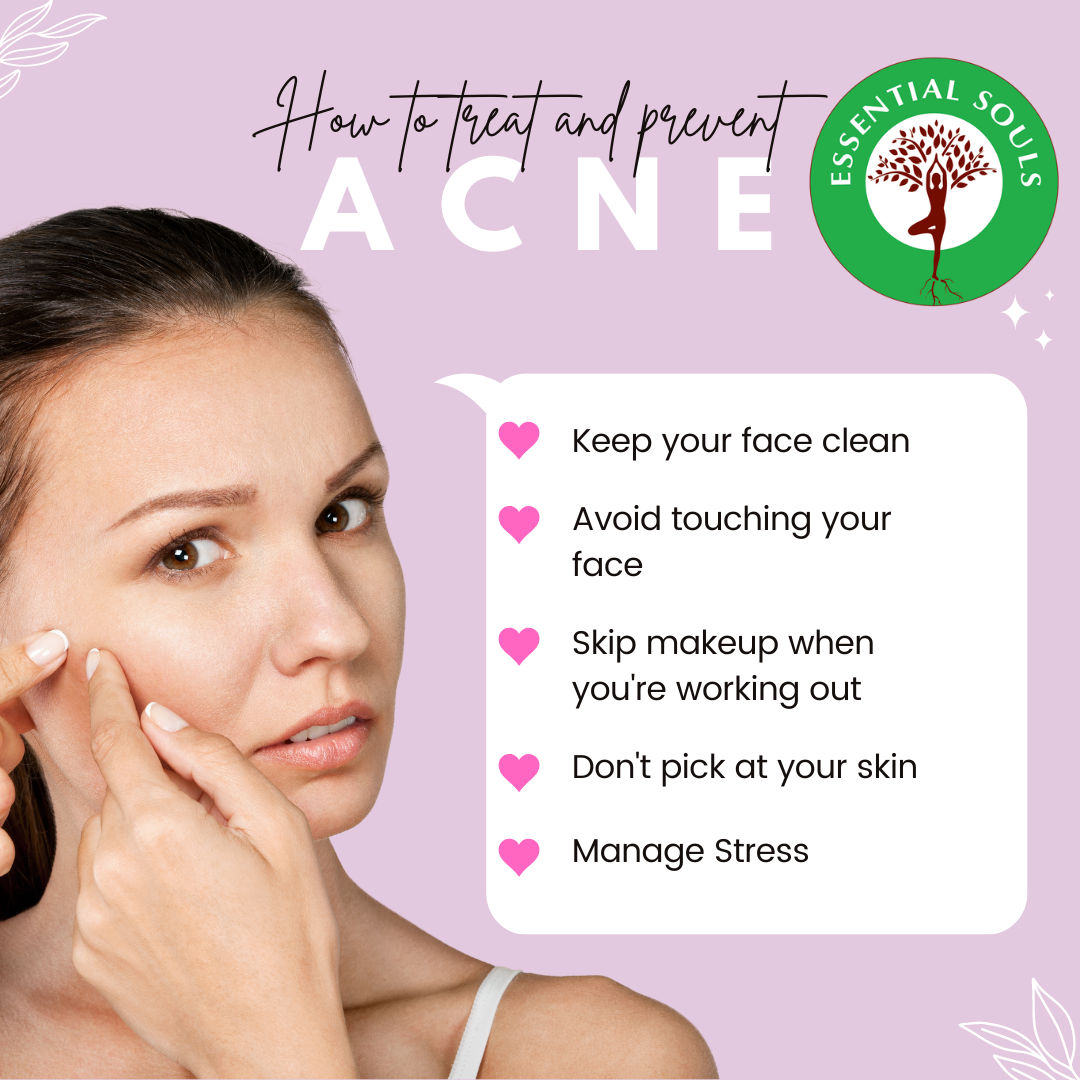 7 Effective Strategies to Treat and Prevent Acne